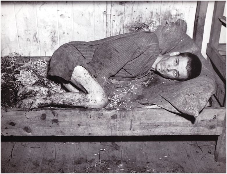 Mauthausen - A half-dead prisoner found lying in his own filth